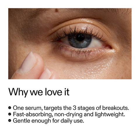 The INKEY List - 360° Skin Clearing Serum Fantastic Look Albania Tirana