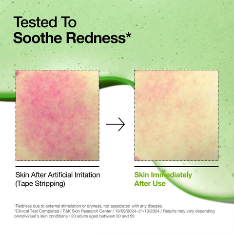 Anua - Azelaic Acid 10 + Hyaluron Serum 30ml Fantastic Look Albania Tirana