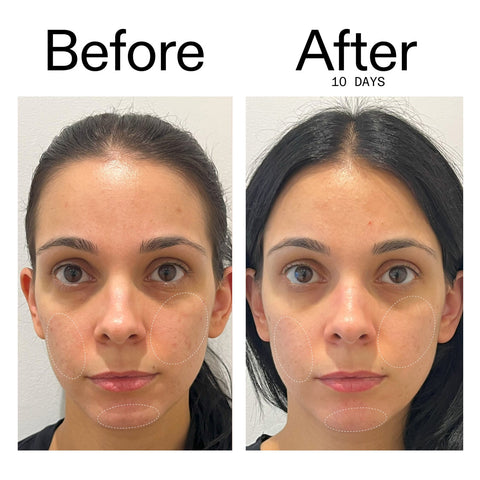 The INKEY List - Biome Balancing Moisturiser 50ml Fantastic Look Albania Tirana