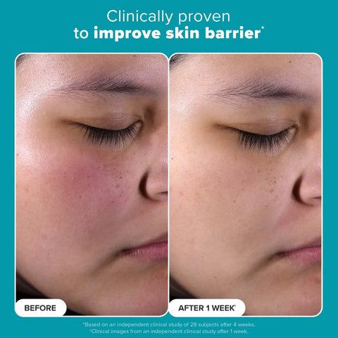 Paula's Choice - EXFOLIATE 2% BHA Liquid Exfoliant 236ml Fantastic Look Albania Tirana