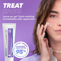 Acnecide - Face Gel Spot Treatment with 5% Benzoyl Peroxide Fantastic Look Albania Tirana