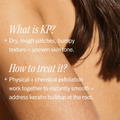 First Aid Beauty - KP Bump Eraser Body Scrub 10% AHA 226g Fantastic Look Albania Tirana