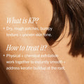 First Aid Beauty - KP Bump Eraser Body Scrub 10% AHA 59.2g Fantastic Look Albania Tirana