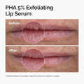 The Ordinary - PHA 5% Exfoliating Lip Serum Fantastic Look Albania Tirana