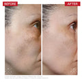 Dr. Levy - Radical3 Reboot Pro Peel Fantastic Look Albania Tirana