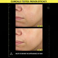 Allies Of Skin - Retinal 0.1% & Peptides Advanced Repair Night Cream 20ml Fantastic Look Albania Tirana