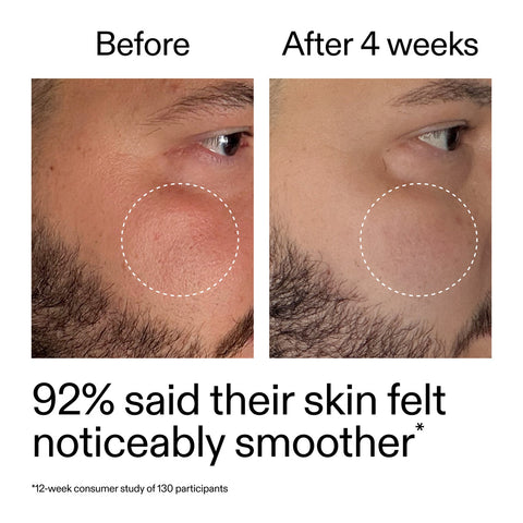 The INKEY List - Starter Retinol Serum 30ml Fantastic Look Albania Tirana