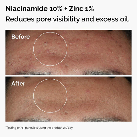 The Ordinary - The Skin Support Set Fantastic Look Albania Tirana