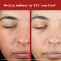 Elta MD - UV Skin Recovery Red Color Correcting Green Tint Broad Spectrum SPF 50 48g Fantastic Look Albania Tirana